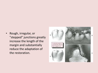 • Rough, irregular, or
"stepped" junctions greatly
increase the length of the
margin and substantially
reduce the adaptation of
the restoration.
 