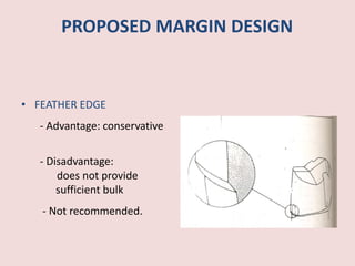 PROPOSED MARGIN DESIGN
• FEATHER EDGE
- Advantage: conservative
- Disadvantage:
does not provide
sufficient bulk
- Not recommended.
 
