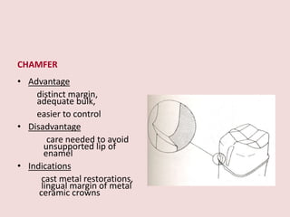 CHAMFER
• Advantage
distinct margin,
adequate bulk,
easier to control
• Disadvantage
care needed to avoid
unsupported lip of
enamel
• Indications
cast metal restorations,
lingual margin of metal
ceramic crowns
 