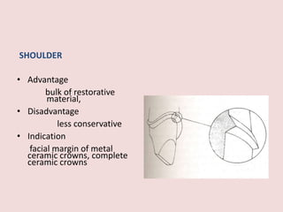 SHOULDER
• Advantage
bulk of restorative
material,
• Disadvantage
less conservative
• Indication
facial margin of metal
ceramic crowns, complete
ceramic crowns
 