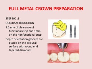 FULL METAL CROWN PREPARATION
STEP NO :1
OCCLUSAL REDUCTION
1.5 mm of clearance of
functional cusp and 1mm
on the nonfunctional cusp.
Depth orientation grooves are
placed on the occlusal
surface with round end
tapered diamond.
 