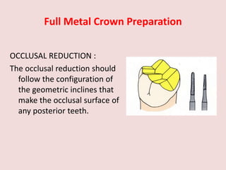Full Metal Crown Preparation
OCCLUSAL REDUCTION :
The occlusal reduction should
follow the configuration of
the geometric inclines that
make the occlusal surface of
any posterior teeth.
 