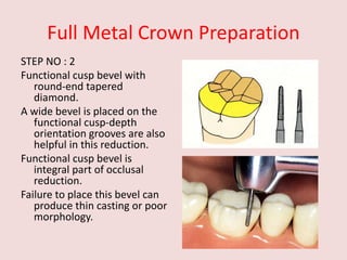 Full Metal Crown Preparation
STEP NO : 2
Functional cusp bevel with
round-end tapered
diamond.
A wide bevel is placed on the
functional cusp-depth
orientation grooves are also
helpful in this reduction.
Functional cusp bevel is
integral part of occlusal
reduction.
Failure to place this bevel can
produce thin casting or poor
morphology.
 