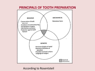 PRINCIPALS OF TOOTH PREPARATION
According to Rosentsteil
 
