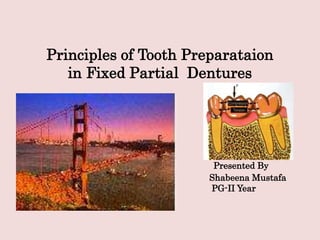 Principles of Tooth Preparataion
in Fixed Partial Dentures
Presented By
Shabeena Mustafa
PG-II Year
 