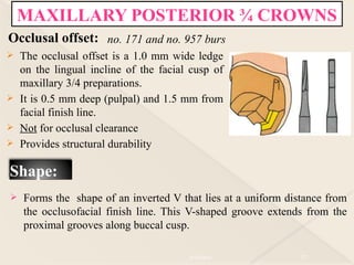 Comprehensive Guide to Pre-Clinical Partial Coverage Crowns in Fixed ...