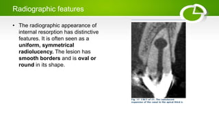 Radiographic features
• The radiographic appearance of
internal resorption has distinctive
features. It is often seen as a
uniform, symmetrical
radiolucency. The lesion has
smooth borders and is oval or
round in its shape.
 