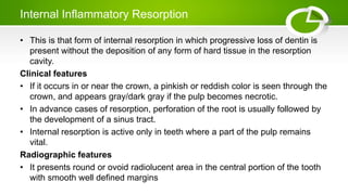 Internal Inflammatory Resorption
• This is that form of internal resorption in which progressive loss of dentin is
present without the deposition of any form of hard tissue in the resorption
cavity.
Clinical features
• If it occurs in or near the crown, a pinkish or reddish color is seen through the
crown, and appears gray/dark gray if the pulp becomes necrotic.
• In advance cases of resorption, perforation of the root is usually followed by
the development of a sinus tract.
• Internal resorption is active only in teeth where a part of the pulp remains
vital.
Radiographic features
• It presents round or ovoid radiolucent area in the central portion of the tooth
with smooth well defined margins
 
