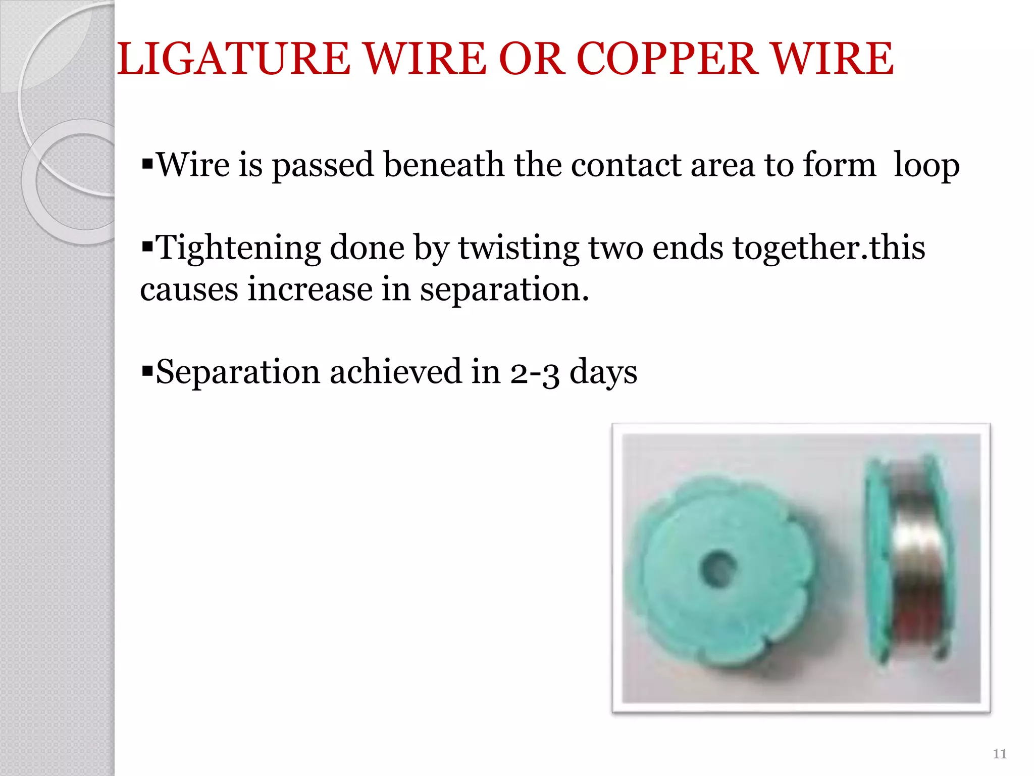 LIGATURE WIRE OR COPPER WIRE
Wire is passed beneath the contact area to form loop
Tightening done by twisting two ends together.this
causes increase in separation.
Separation achieved in 2-3 days
11
 