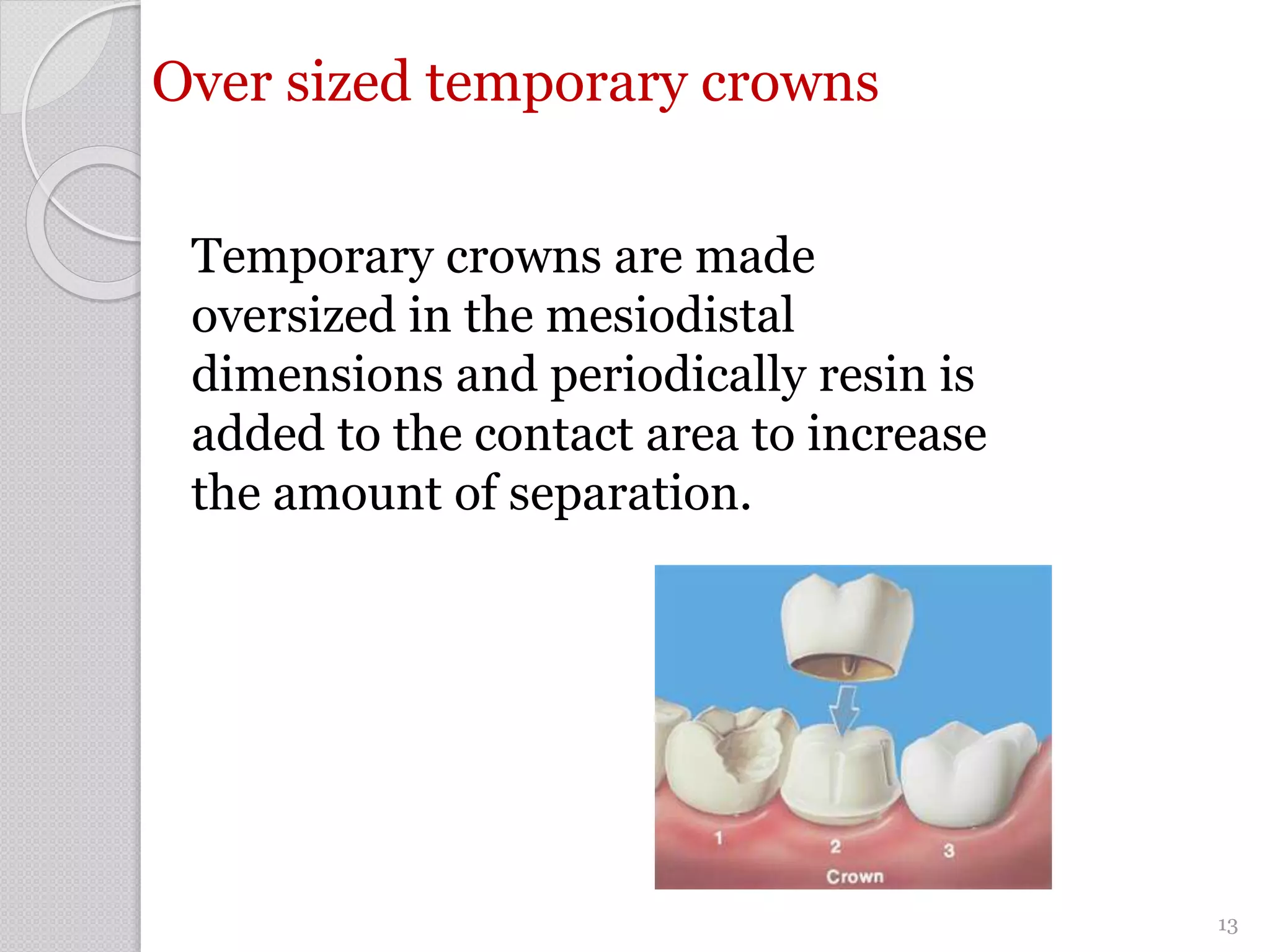 Over sized temporary crowns
Temporary crowns are made
oversized in the mesiodistal
dimensions and periodically resin is
added to the contact area to increase
the amount of separation.
13
 
