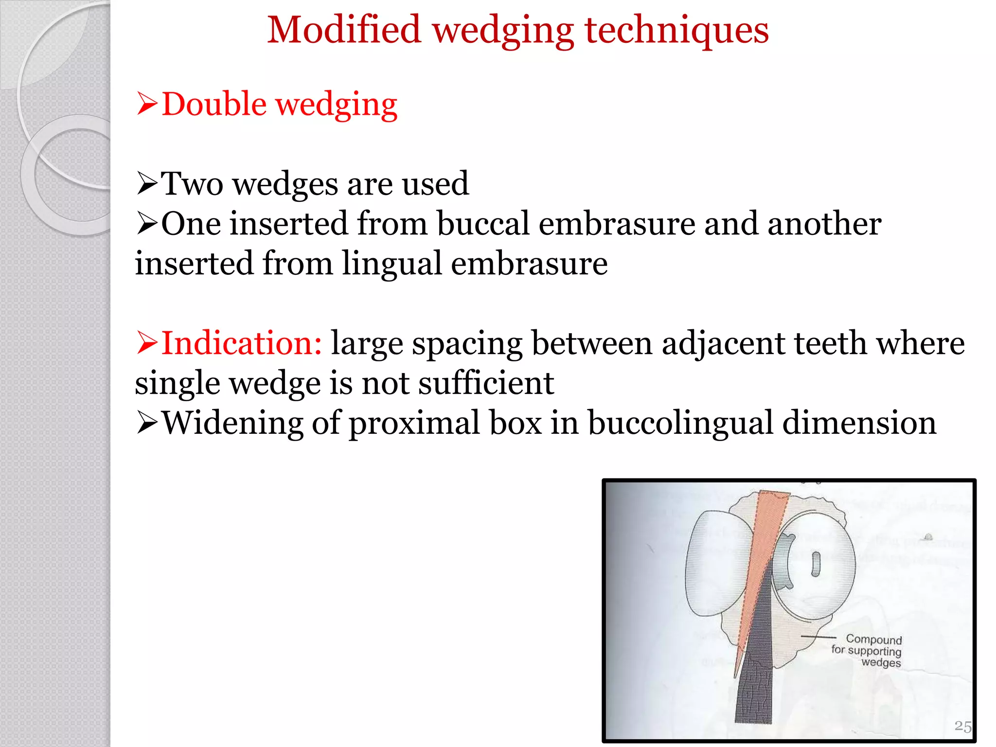 Modified wedging techniques
Double wedging
Two wedges are used
One inserted from buccal embrasure and another
inserted from lingual embrasure
Indication: large spacing between adjacent teeth where
single wedge is not sufficient
Widening of proximal box in buccolingual dimension
25
 
