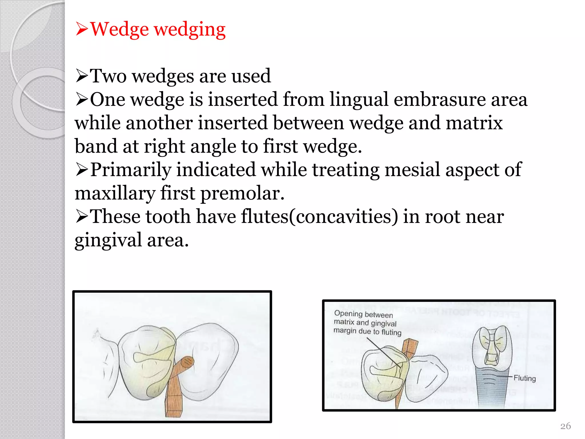 Wedge wedging
Two wedges are used
One wedge is inserted from lingual embrasure area
while another inserted between wedge and matrix
band at right angle to first wedge.
Primarily indicated while treating mesial aspect of
maxillary first premolar.
These tooth have flutes(concavities) in root near
gingival area.
26
 
