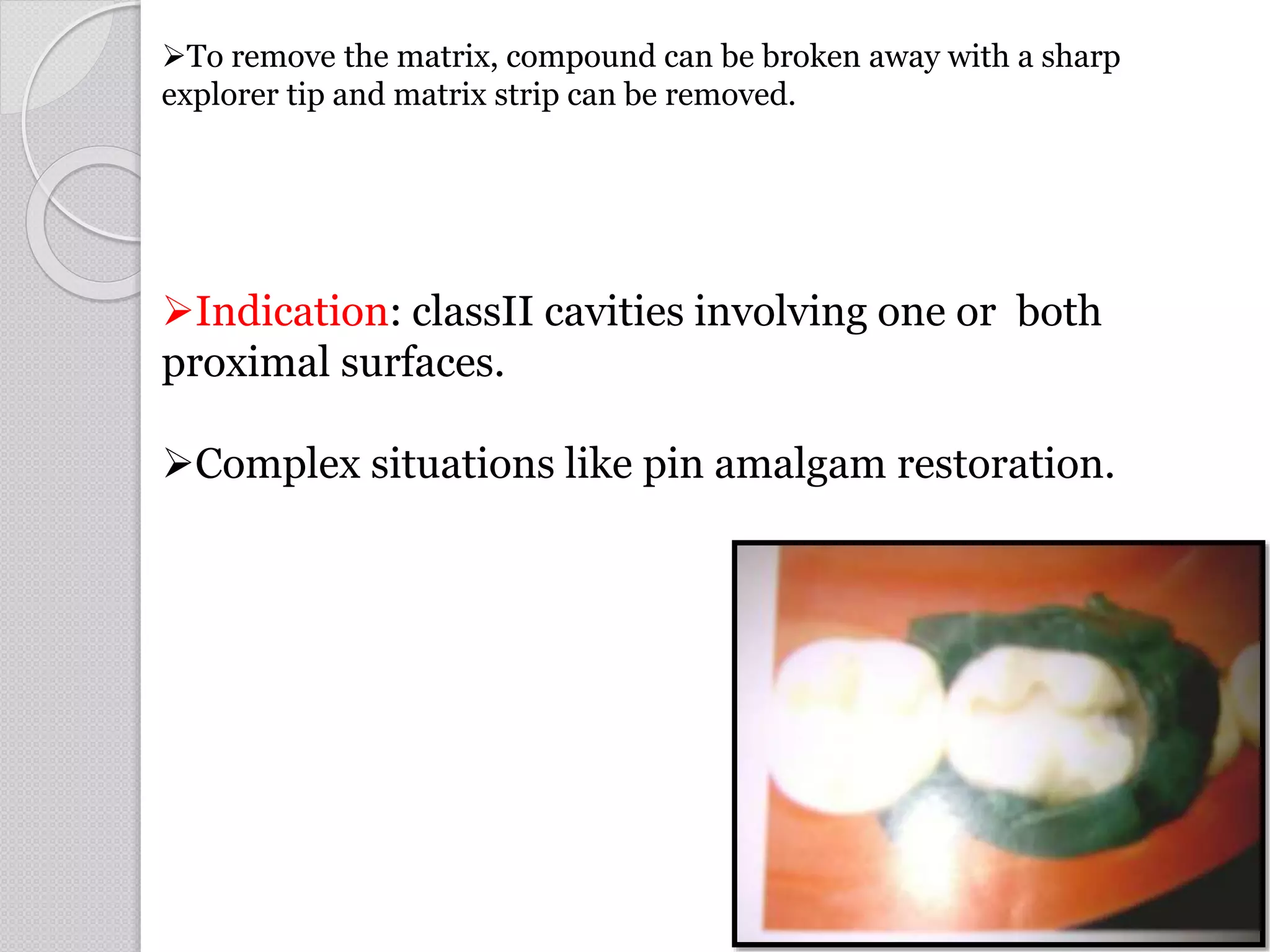 Indication: classII cavities involving one or both
proximal surfaces.
Complex situations like pin amalgam restoration.
To remove the matrix, compound can be broken away with a sharp
explorer tip and matrix strip can be removed.
52
 