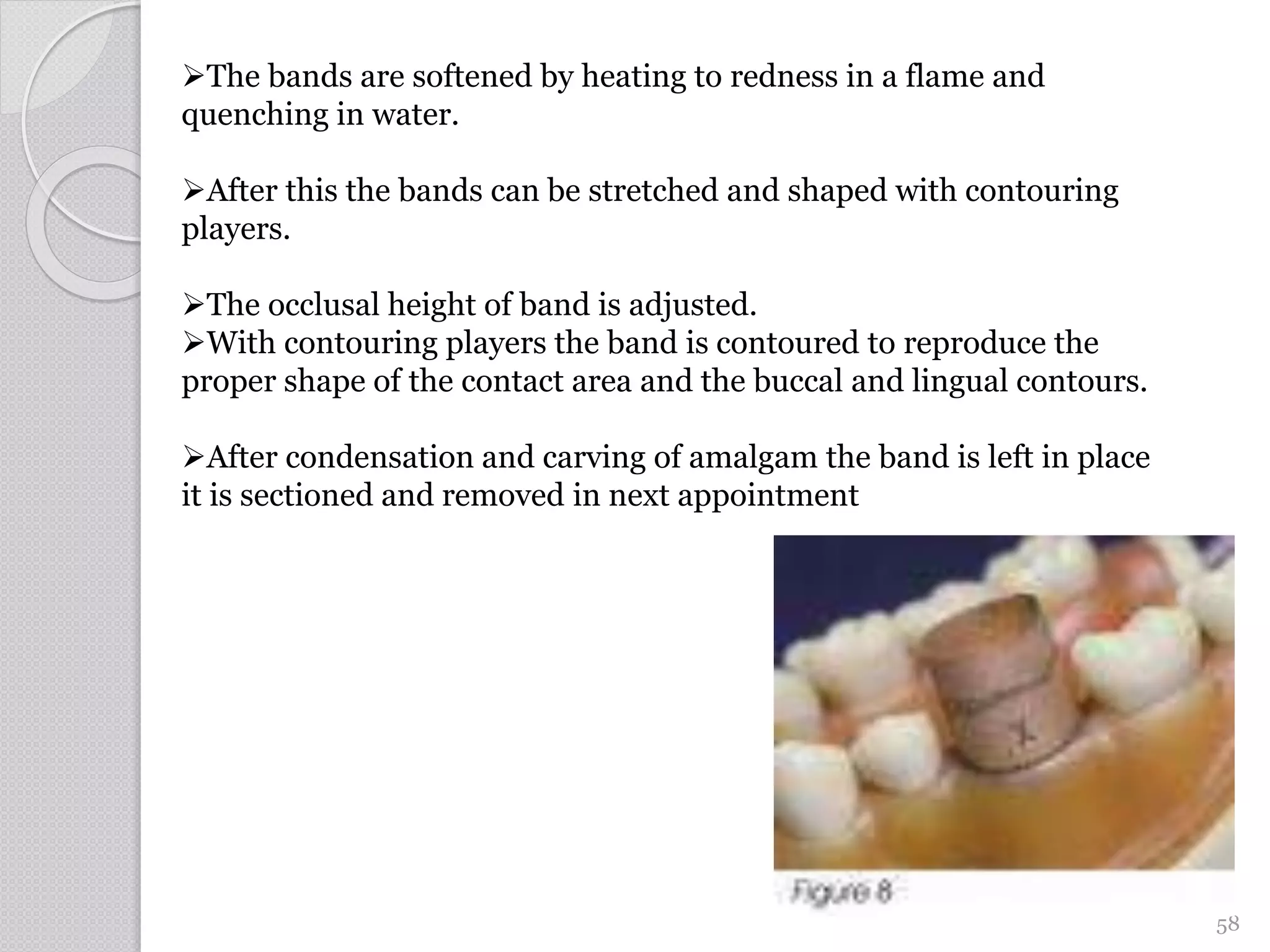 58
The bands are softened by heating to redness in a flame and
quenching in water.
After this the bands can be stretched and shaped with contouring
players.
The occlusal height of band is adjusted.
With contouring players the band is contoured to reproduce the
proper shape of the contact area and the buccal and lingual contours.
After condensation and carving of amalgam the band is left in place
it is sectioned and removed in next appointment
 