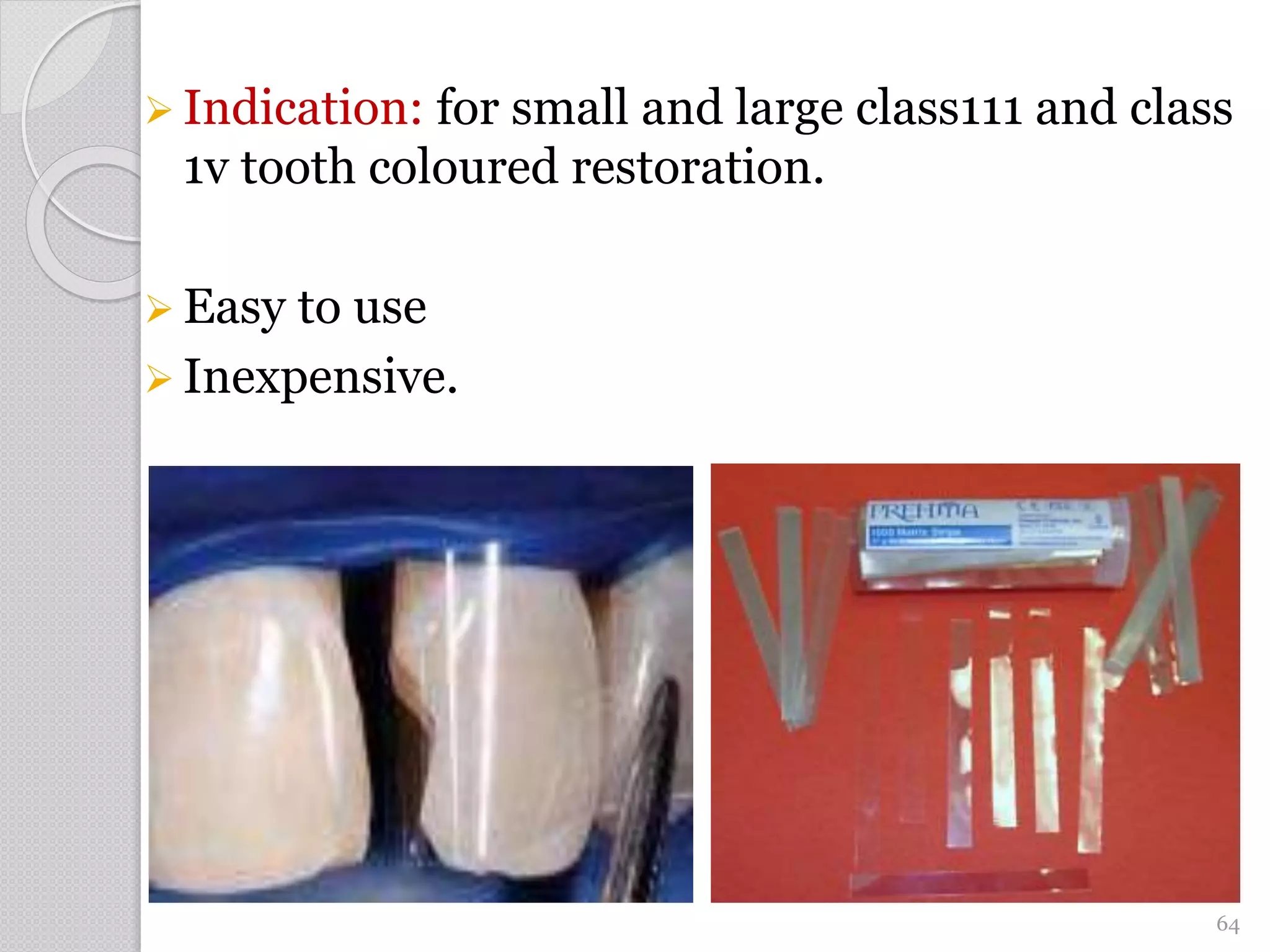  Indication: for small and large class111 and class
1v tooth coloured restoration.
 Easy to use
 Inexpensive.
64
 