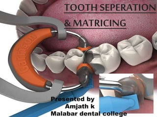 TOOTH SEPERATION
& MATRICING
Presented by
Amjath k
Malabar dental college
 