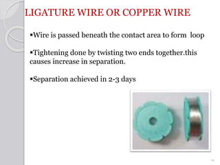 LIGATURE WIRE OR COPPER WIRE
Wire is passed beneath the contact area to form loop
Tightening done by twisting two ends t...