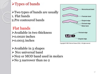Types of bands
Two types of bands are usually used
1. Flat bands
2.Pre contoured bands
Flat bands
Available in two thic...