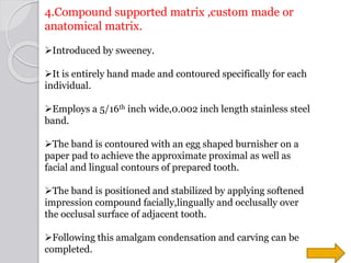 4.Compound supported matrix ,custom made or
anatomical matrix.
Introduced by sweeney.
It is entirely hand made and conto...