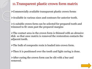 11.Transparent plastic crown form matrix
Commercially available transparent plastic crown forms
Available in various siz...