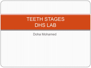 TEETH STAGES
   DHS LAB
  Doha Mohamed
 