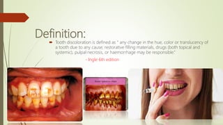 Definition:
 Tooth discoloration is defined as “ any change in the hue, color or translucency of
a tooth due to any cause; restorative filling materials, drugs (both topical and
systemic), pulpal necrosis, or haemorrhage may be responsible.”
- Ingle 6th edition
 