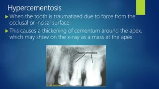 Tooth Structures, Periodontium, and Caries Classifications Powerpoint ...