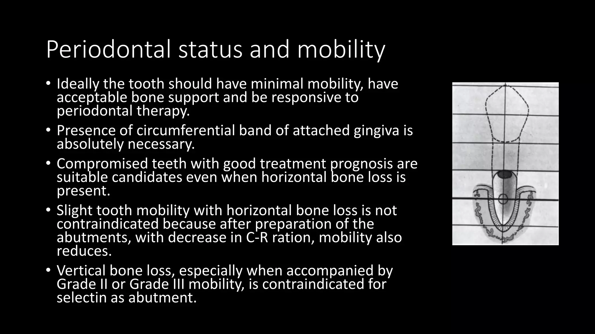 Tooth supported Overdentures | PPTX