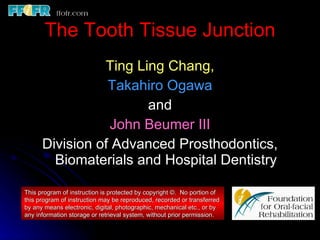 The Tooth Tissue Junction ,[object Object],[object Object],[object Object],[object Object],[object Object],This program of instruction is protected by copyright ©.  No portion of this program of instruction may be reproduced, recorded or transferred by any means electronic, digital, photographic, mechanical etc., or by any information storage or retrieval system, without prior permission. 