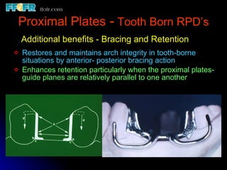 Tooth tissue junction, major and minor connectors | PPT
