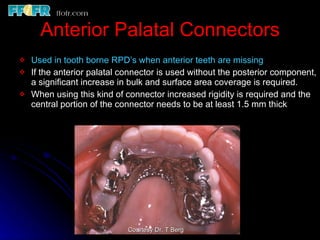 Tooth tissue junction, major and minor connectors | PPT