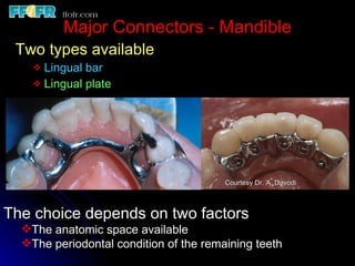 Tooth tissue junction, major and minor connectors | PPT