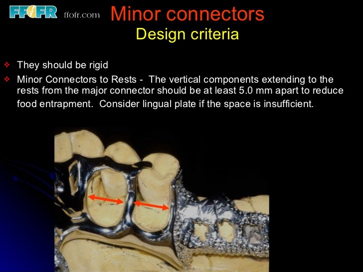 Tooth tissue junction, major and minor connectors