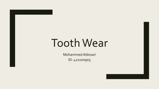 ToothWear
MohammedAldosari
ID: 421100905
 