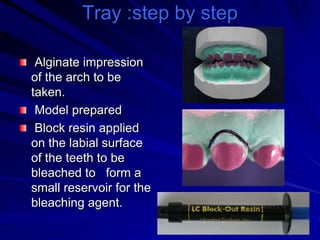 Tray :step by step
Alginate impression
of the arch to be
taken.
Model prepared
Block resin applied
on the labial surface
of the teeth to be
bleached to form a
small reservoir for the
bleaching agent.

 