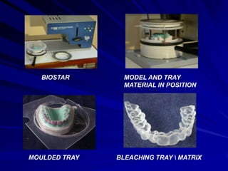 BIOSTAR

MODEL AND TRAY
MATERIAL IN POSITION

MOULDED TRAY

BLEACHING TRAY  MATRIX

 