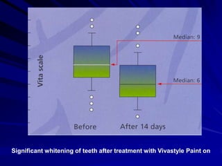 Significant whitening of teeth after treatment with Vivastyle Paint on

 