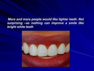 More and more people would like lighter teeth. Not
surprising –as nothing can improve a smile like
bright white teeth

 