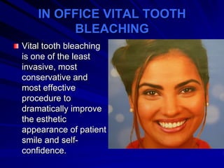 IN OFFICE VITAL TOOTH
BLEACHING
Vital tooth bleaching
is one of the least
invasive, most
conservative and
most effective
procedure to
dramatically improve
the esthetic
appearance of patient
smile and selfconfidence.

 