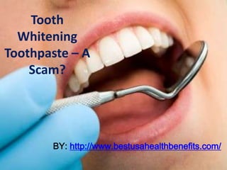 Tooth
  Whitening
Toothpaste – A
    Scam?




       BY: http://www.bestusahealthbenefits.com/
 