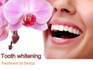 Treatment at Dentzz
Tooth whitening
 