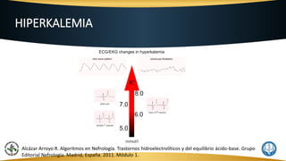 HIPERKALEMIA
Alcázar Arroyo R. Algoritmos en Nefrología. Trastornos hidroelectrolíticos y del equilibrio ácido-base. Grupo
Editorial Nefrología. Madrid, España. 2011. Módulo 1.
 