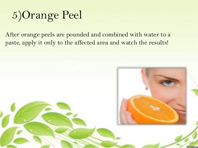 Home Remedies For Pimples N Blackheads Home Remedies For Pimples N Blackheads