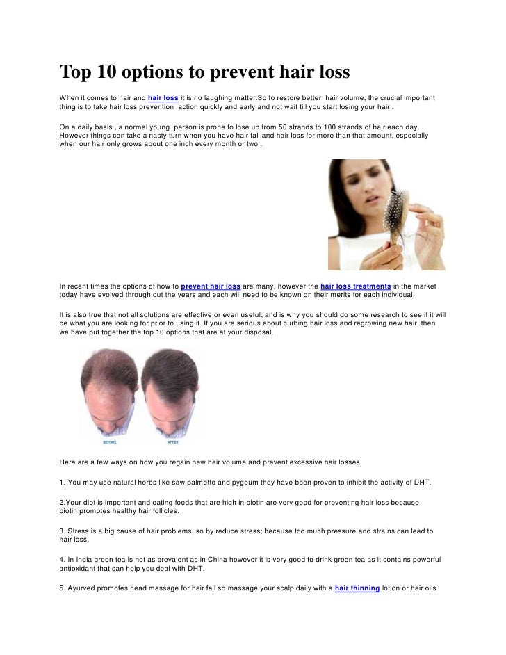 Top 10 Options To Prevent Hair Loss
