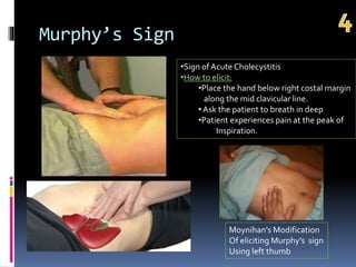 Morphy Signs Top 10 signs in gastroenterology | PPTX