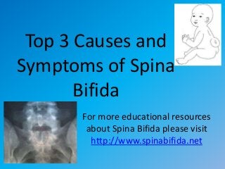 Top 3 Causes and
Symptoms of Spina
Bifida
For more educational resources
about Spina Bifida please visit
http://www.spinabifida.net
 