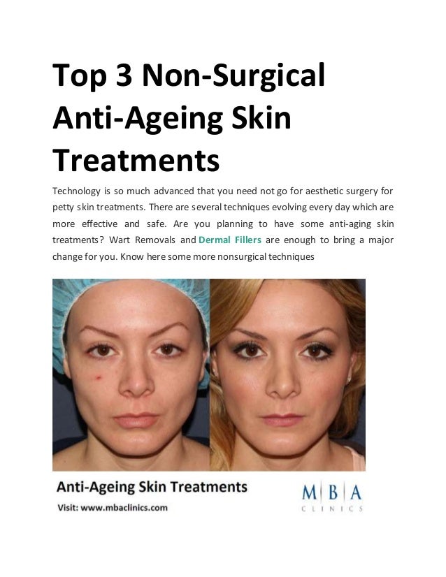best skin procedures for aging skin