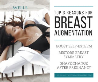 Top 3 reasons for breast augmentation