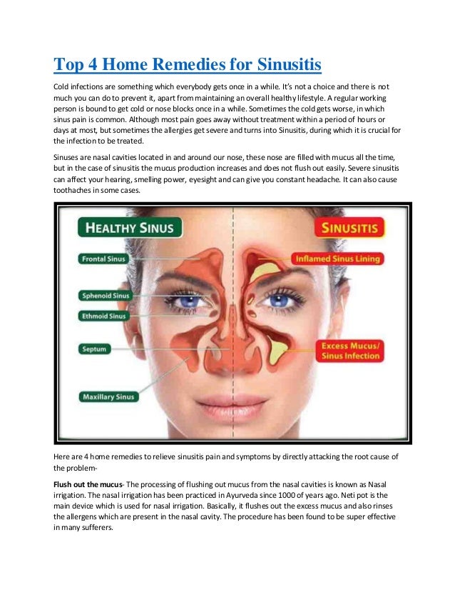 Maxillary Sinusitis Home Remedy