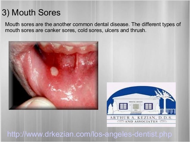 mouth types problems of dental problems common 5 Top